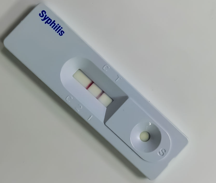 Syfilis antigen Rapid Test Strip